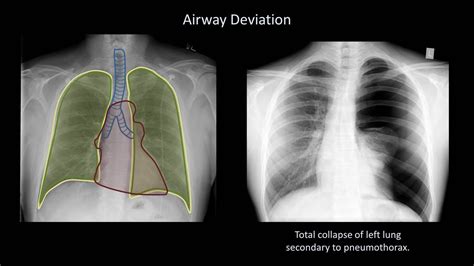 which radiographic test shows soft tissue best|types of x ray tests.